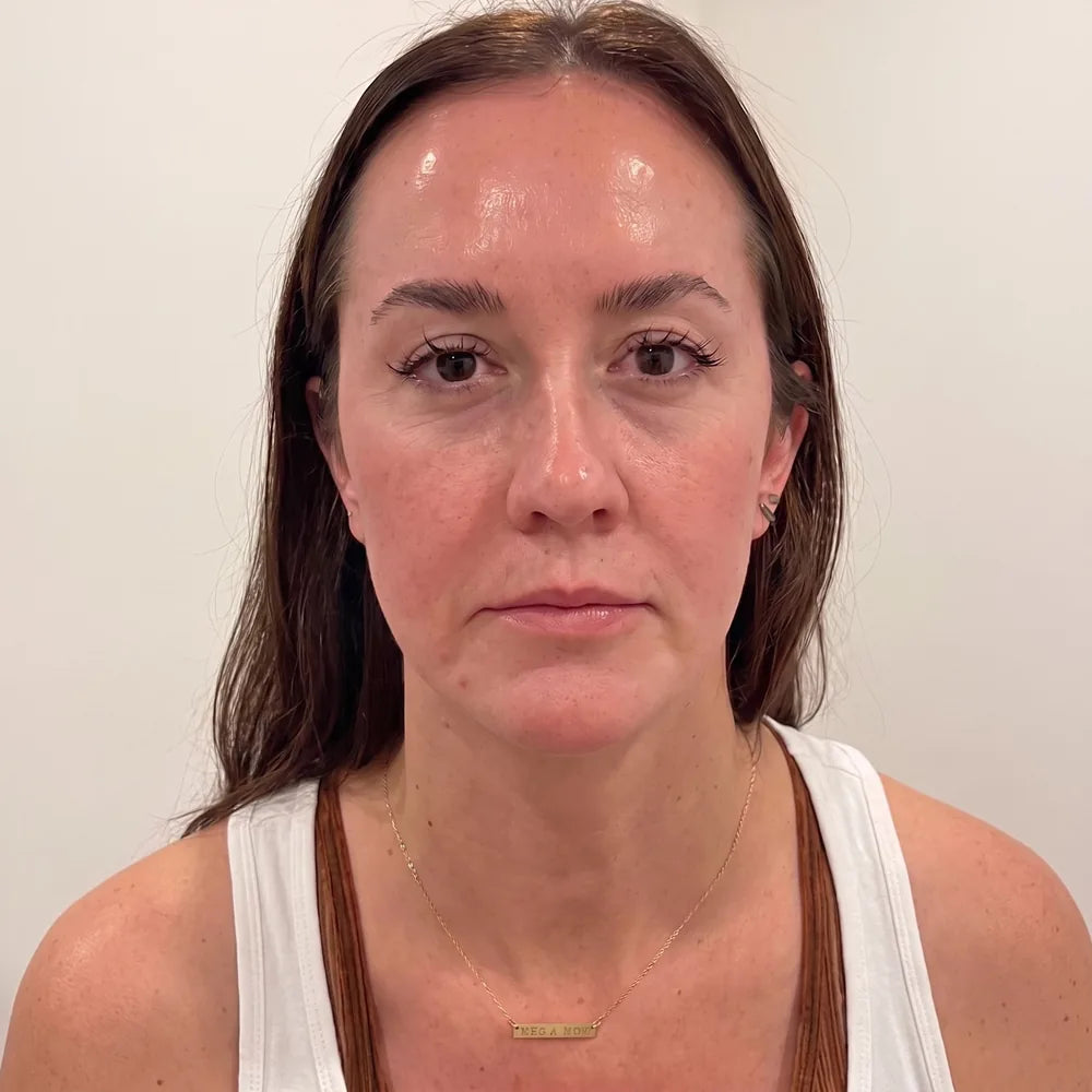 Peau du visage après l’utilisation régulière du baume