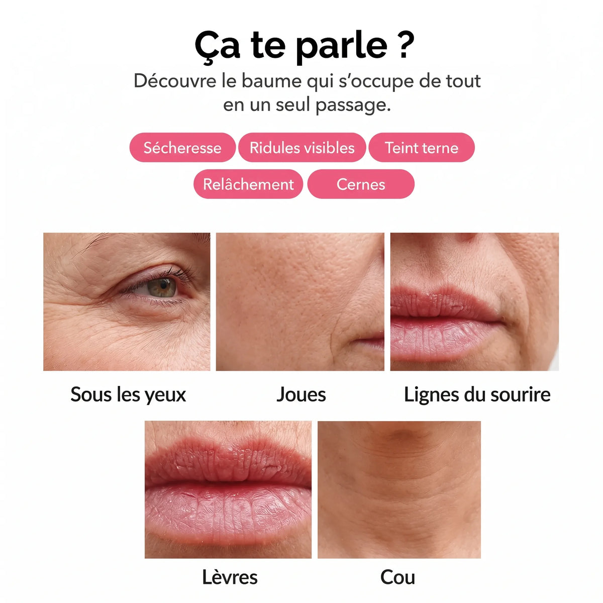 Sécheresse, ridules, teint terne, relâchement, cernes : les zones concernées