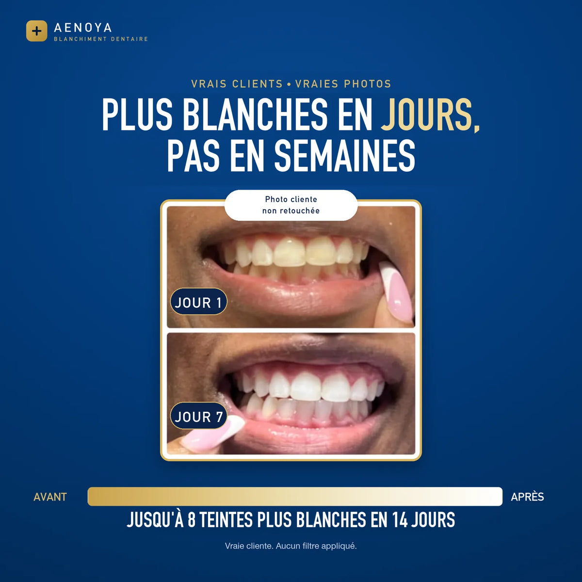 Avant / après : dents plus blanches du jour 1 au jour 7