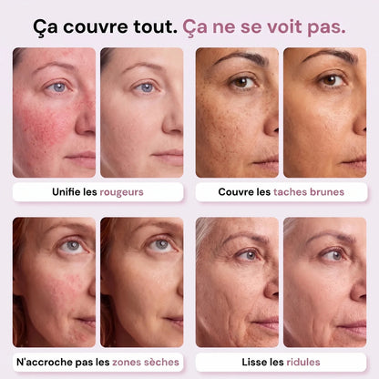 Rougeurs, taches, zones sèches et ridules avant / après
