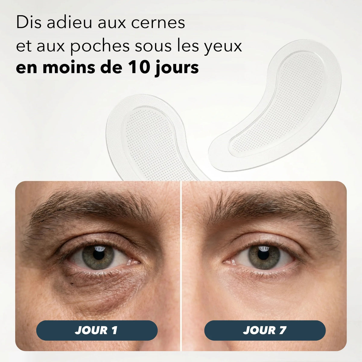 Contour de l'œil au jour 1 et au jour 7