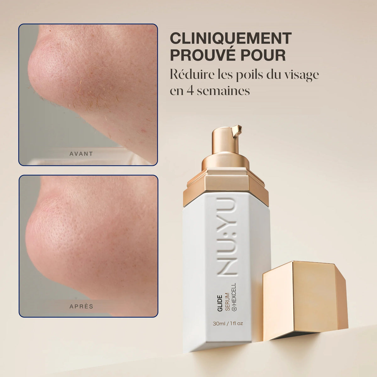 Cliniquement prouvé pour réduire les poils du visage en 4 semaines — avant / après