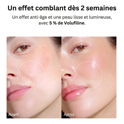 Un effet comblant dès 2 semaines