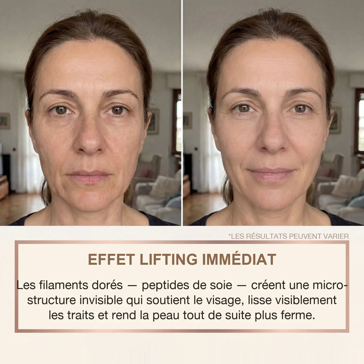 Avant / après : effet lifting immédiat sur le visage