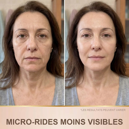 Avant / après : micro-rides moins visibles