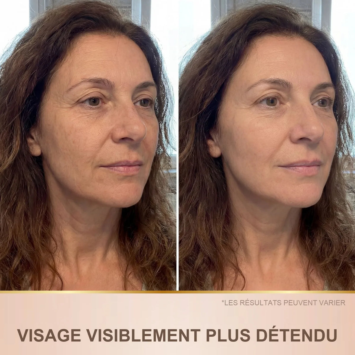 Avant / après : visage visiblement plus détendu