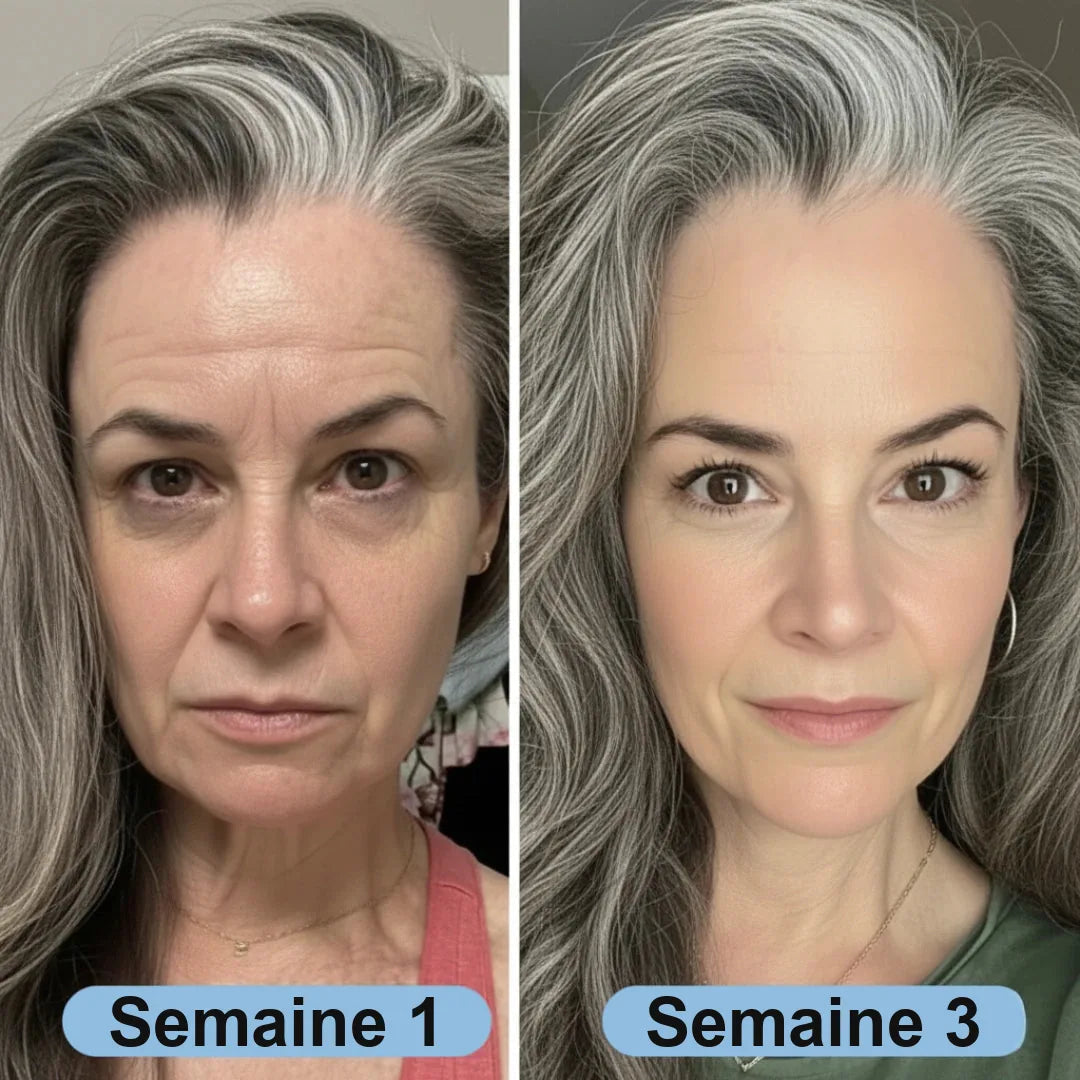 Avant après — semaine 1 et semaine 3
