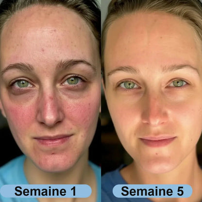 Avant après — semaine 1 et semaine 5