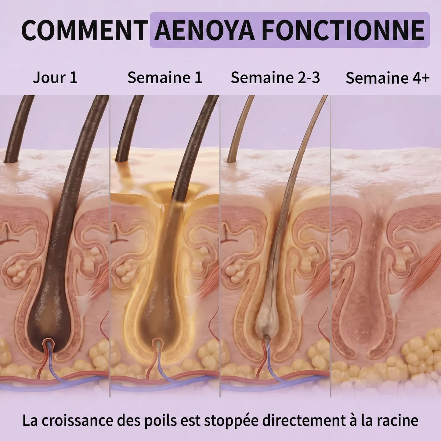 Sérum anti-poils Aenoya