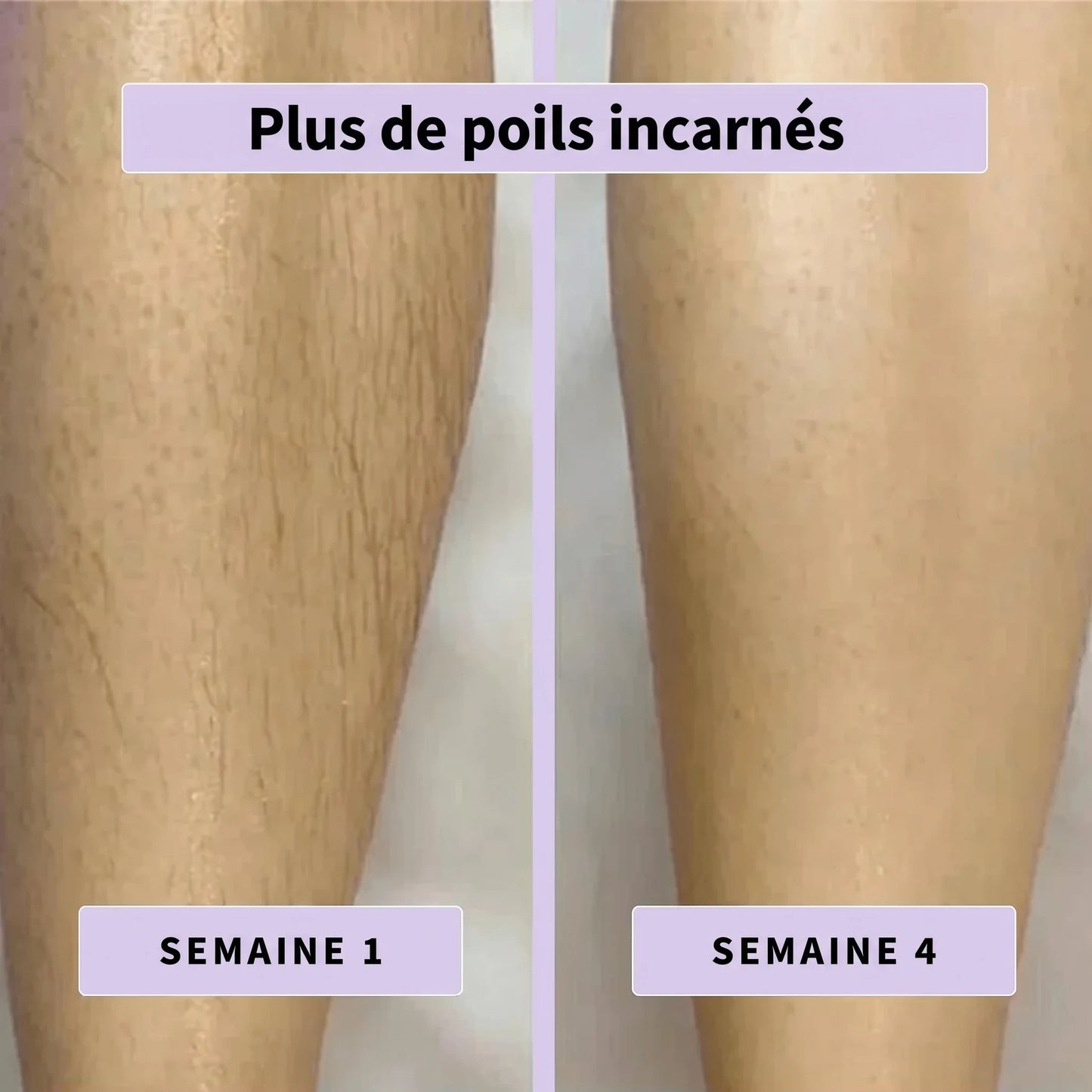Sérum anti-poils Aenoya