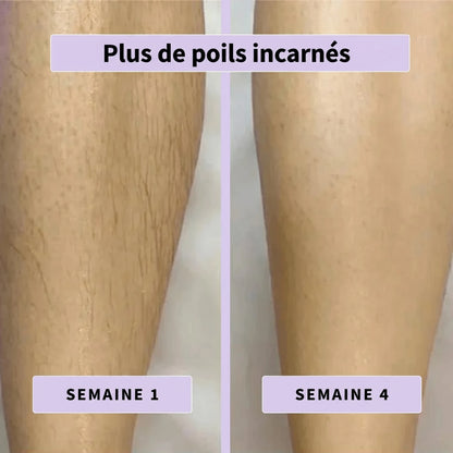 Sérum anti-poils Aenoya