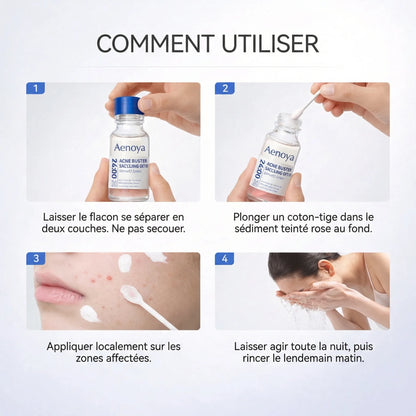 Lotion asséchante Aenoya à 1,8 % d'acide salicylique