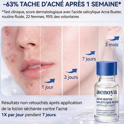 Lotion asséchante Aenoya à 1,8 % d'acide salicylique