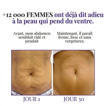 Aenoya - Crème réactivatrice abdominale