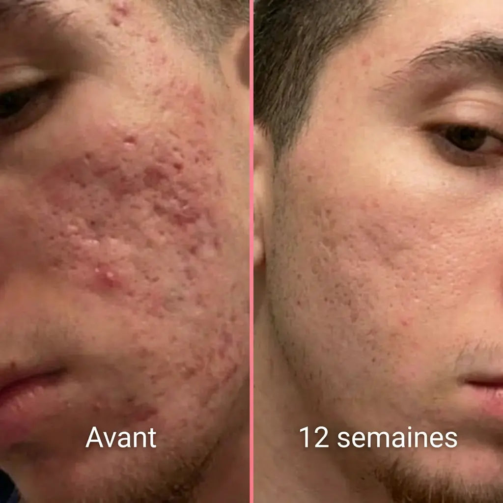Stick Perfecteur de Peau