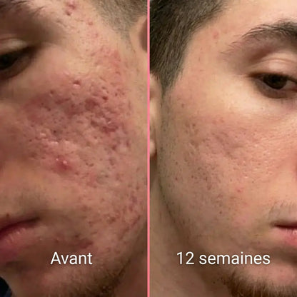Stick Perfecteur de Peau