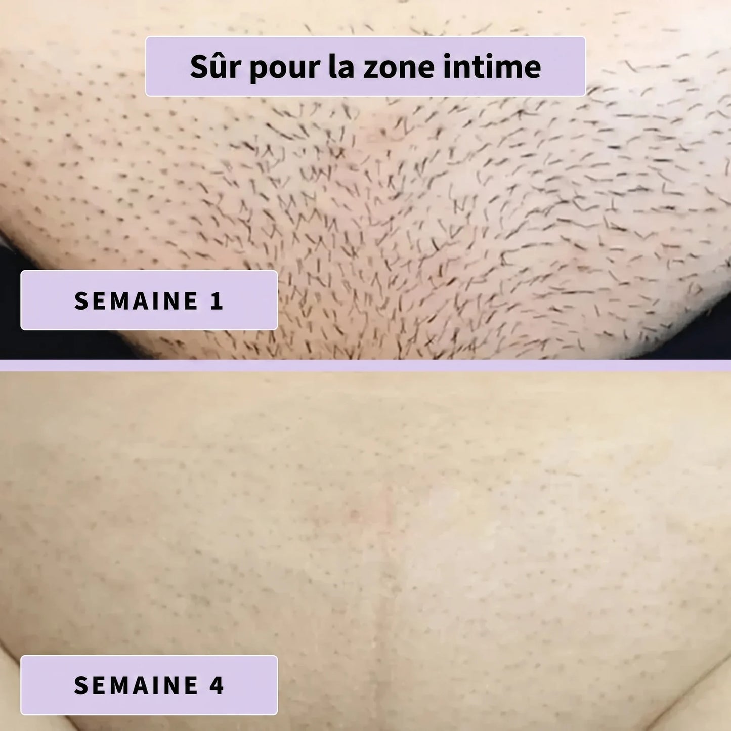Sérum anti-poils Aenoya