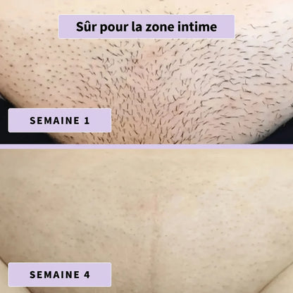 Sérum anti-poils Aenoya
