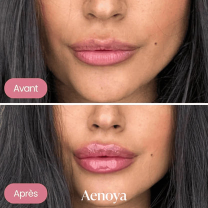 Repulpeur de lèvres Aenoya