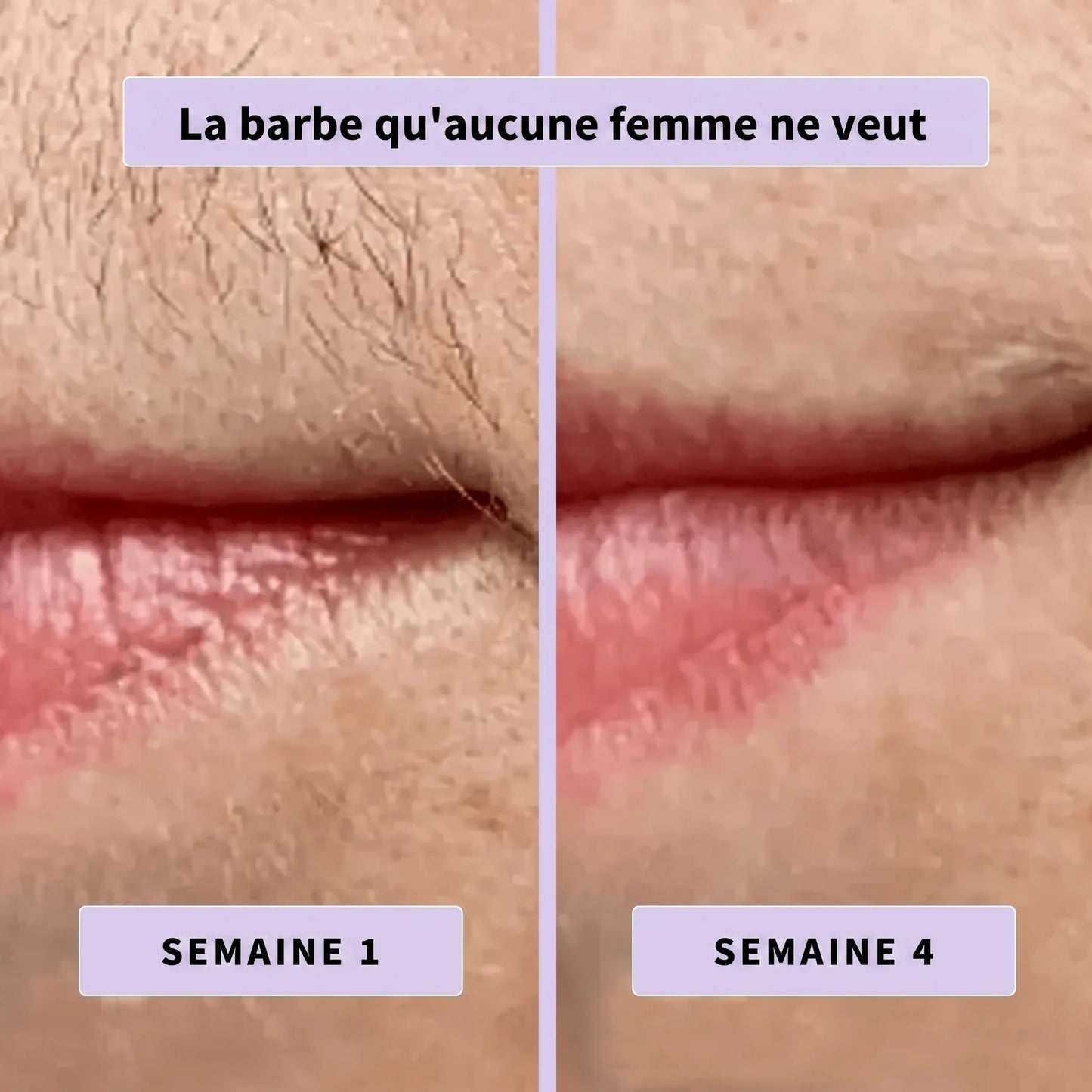 Sérum anti-poils Aenoya