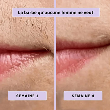 Sérum anti-poils Aenoya
