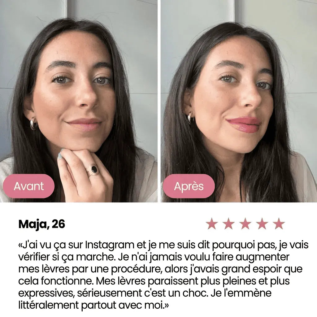 Repulpeur de lèvres Aenoya