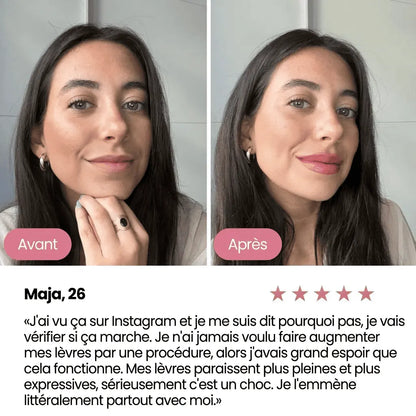 Repulpeur de lèvres Aenoya