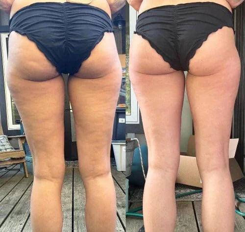 Arri&egrave;re des cuisses, avant et apr&egrave;s