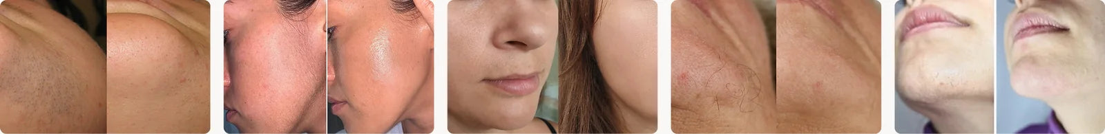 Transformations de clientes