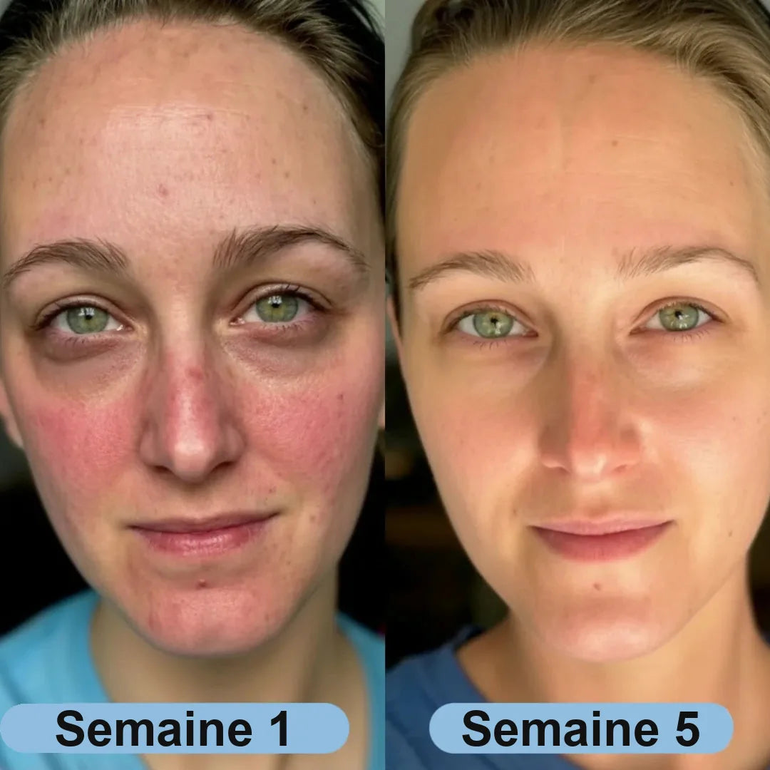 Avant apr&egrave;s sur plusieurs semaines