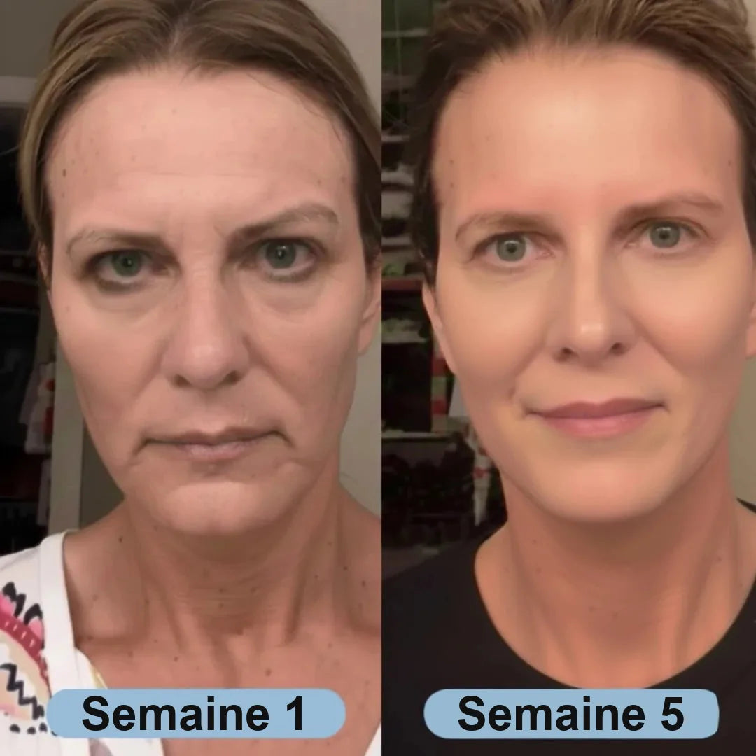 Avant apr&egrave;s sur plusieurs semaines