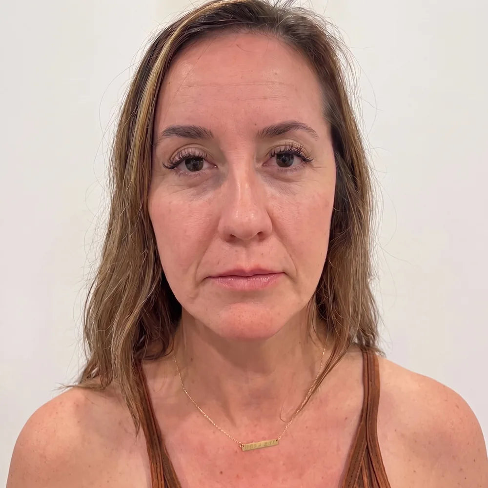 Peau du visage avant l&rsquo;utilisation du baume