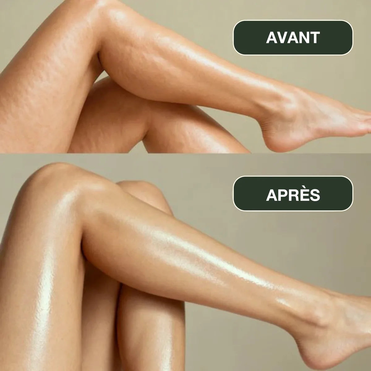 Jambes avant et apr&egrave;s l&rsquo;utilisation r&eacute;guli&egrave;re de l&rsquo;huile